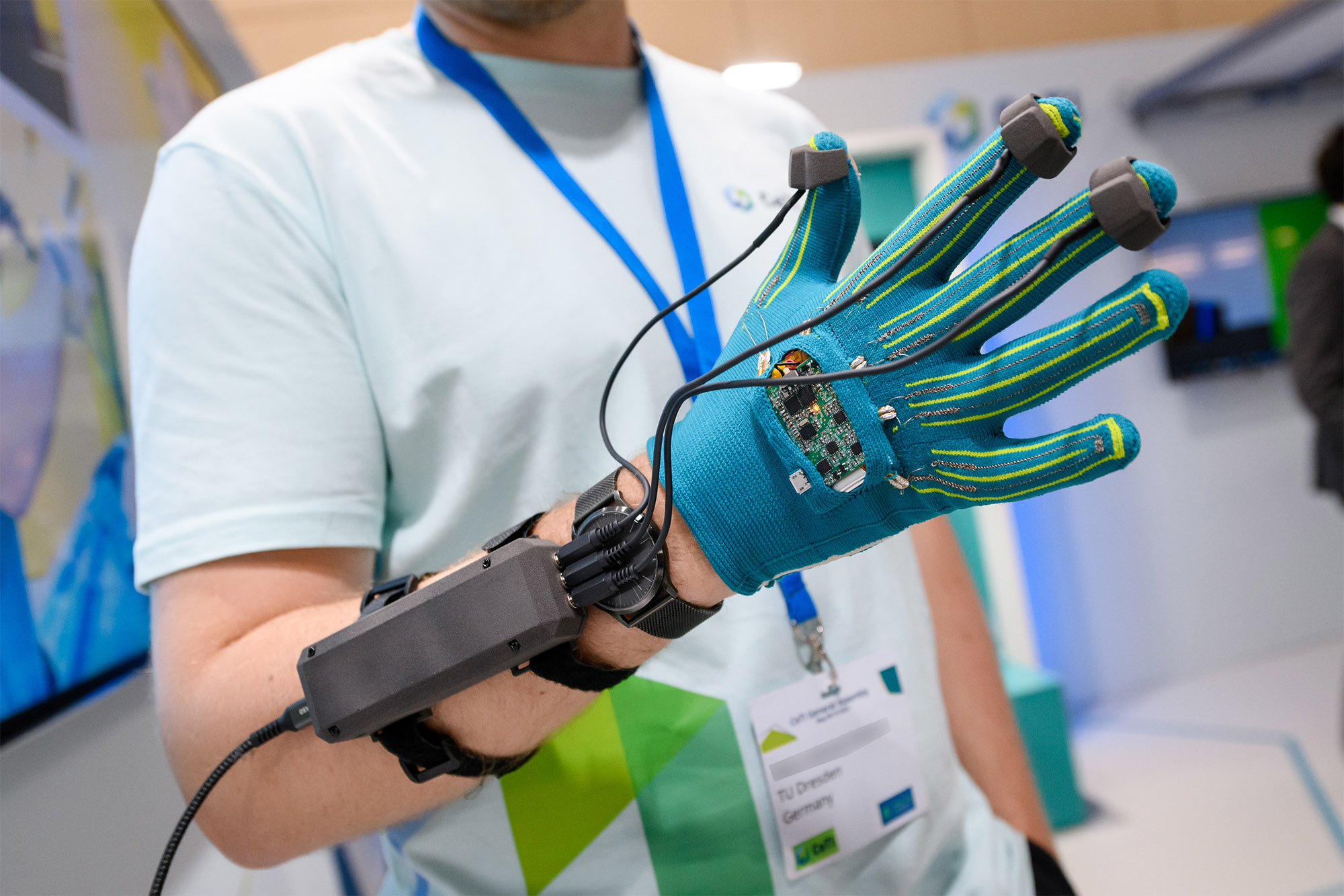 A person wearing a smart glove with sensors attached to the arm